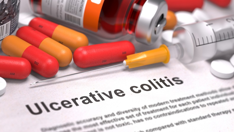 Ulcerative_Colitis