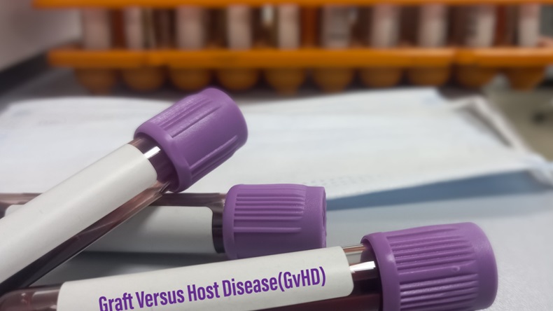 Graft-versus-host disease