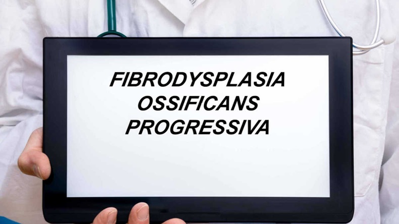 Fibrodysplasia Ossificans Progressiva. Doctor with rare or orphan disease text on tablet screen Fibrodysplasia Ossificans Progressiva