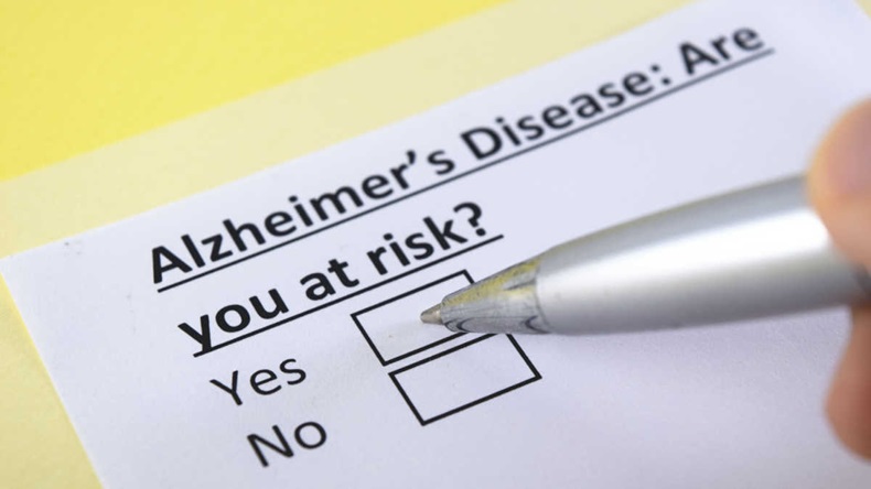 Alzheimer's question
