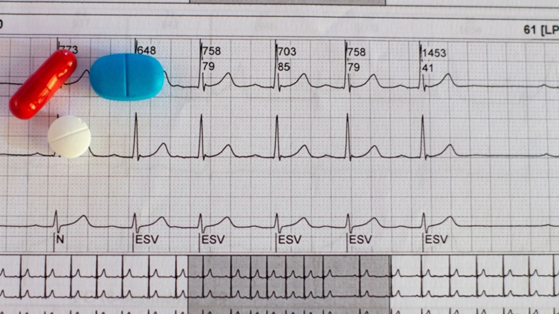 Electrocardiogram_supraventricular_tachycardia_and_colored_pills