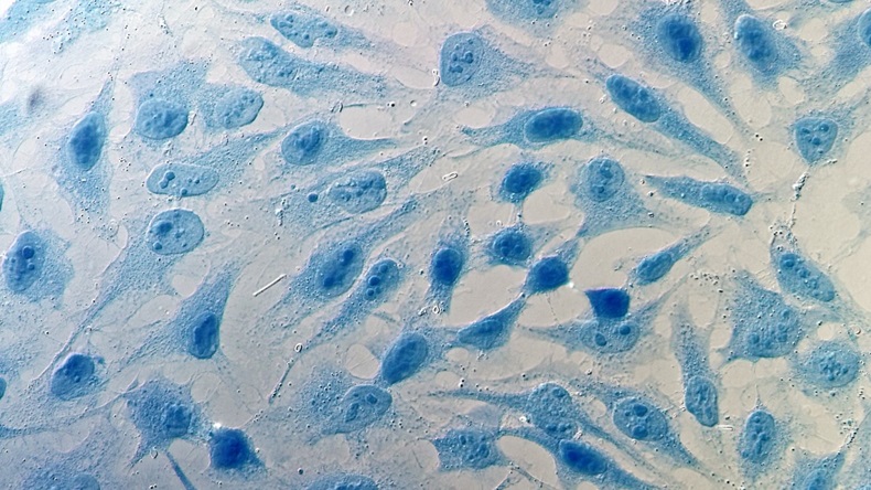 HeLa cells under a microscope