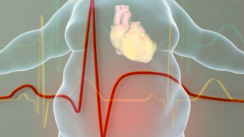 obese heart