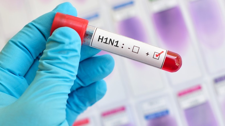 Blood sample positive with H1N1 influenza virus