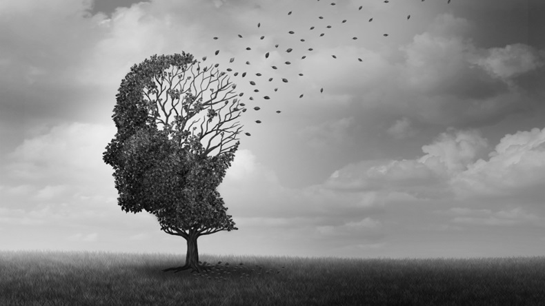 Alzheimer disease as a neuropathology memory loss due to brain degeneration and decline as a surreal medical neurology illness concept.