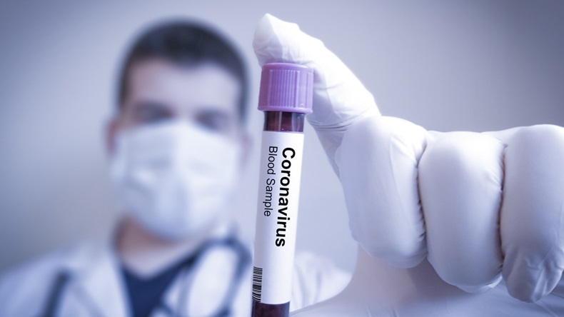 Coronavirus 2019-nCoV Blood Sample. Corona virus outbreaking. Epidemic virus Respiratory Syndrome. China
